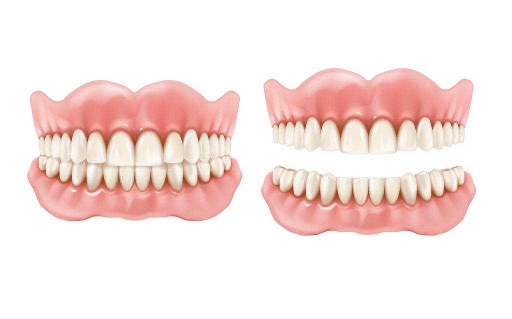 Você conhece a prótese overdenture