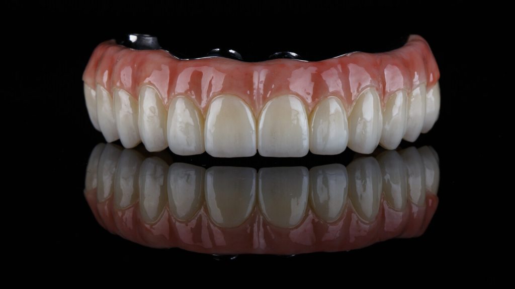 Diga adeus a dentatura com a prótese protocolo!