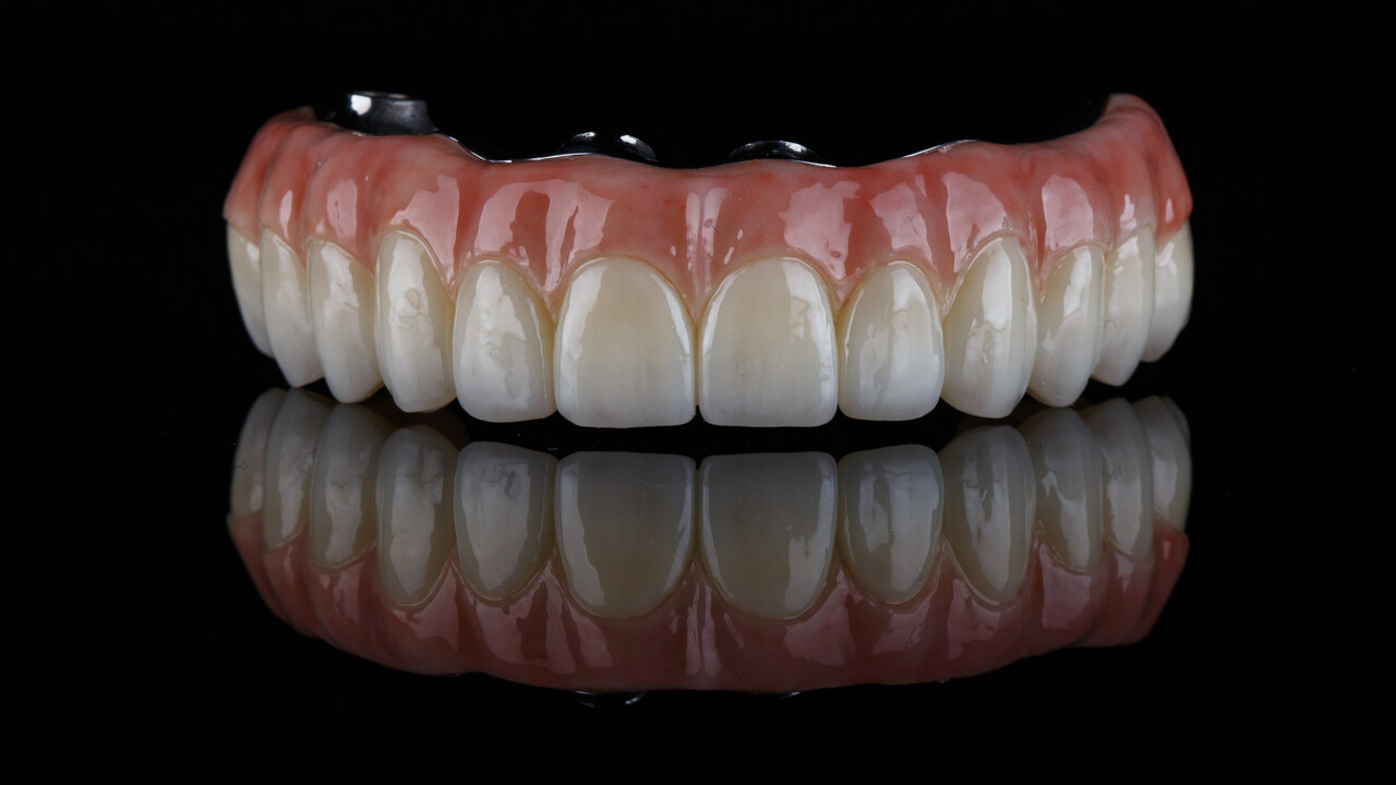 Diga adeus a dentatura com a prótese protocolo!