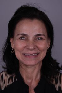 Coroas e facetas de porcelana